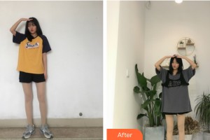 武漢美侖醫(yī)療美容門診部陳遠(yuǎn)海整形價格表附大腿吸脂案例展示