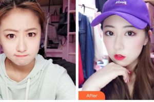 石家莊市中心醫(yī)院整形美容科趙亞平整形價(jià)格表附微針?biāo)獍咐故?>
</a>
<h3 class=