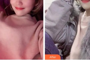 石家莊蘇亞美聯(lián)臣醫(yī)療美容醫(yī)院王俊祥整形價(jià)格表附超聲波潔牙案例展示