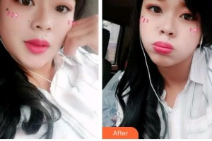 石家莊諾萬醫(yī)療美容醫(yī)院白云濤整形價格表附金屬托槽矯正案例展示