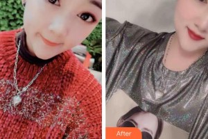 石家莊冀美醫(yī)療美容門診部王立英整形價(jià)格表附鼻部整形案例展示