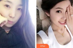 石家莊樂仁堂萬瑞醫(yī)療美容門診部侯彥博整形價(jià)格表附牙齒隱形矯正案例展示