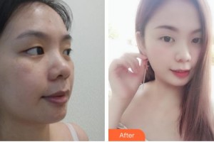 石家莊美萊醫(yī)學(xué)美容醫(yī)院李珊珊整形價(jià)格表附無針?biāo)獍咐故?>
</a>
<h3 class=