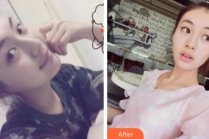 石家莊俏之翼醫(yī)療美容門診部姜?jiǎng)P整形價(jià)格表附光子嫩膚案例展示