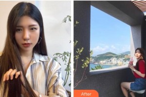 黑龍江省人民醫(yī)院整形美容中心劉俊整形價(jià)格表附切開(kāi)雙眼皮案例展示