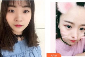 黑龍江美立方醫(yī)療美容醫(yī)院王新東整形價格表附眼部綜合案例展示