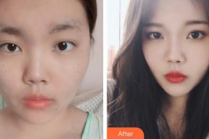 石家莊康體醫(yī)療美容門診部劉曉楠整形價格表附激光祛斑案例展示