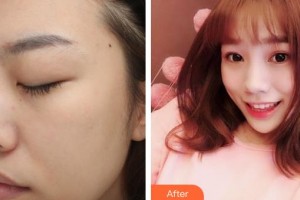 唐山星范醫(yī)療美容門診部杜太超整形價格表附眼部綜合案例展示