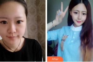 唐山鄧柏林醫(yī)療美容診所鄧柏林整形價格表附鼻部綜合案例展示