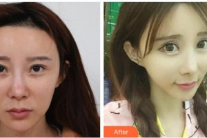 唐山艾玲醫(yī)療美容診所謝艾玲整形價(jià)格表附激光美膚激光案例展示