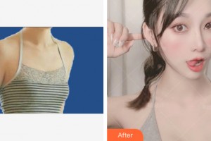 ?？跂|湖醫(yī)學(xué)美容整形醫(yī)院周旭剛整形價(jià)格表附自體脂肪豐胸案例展示