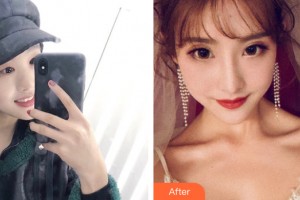 ?？邬i愛醫(yī)療美容醫(yī)院阮凱整形價格表附雙眼皮手術(shù)案例展示