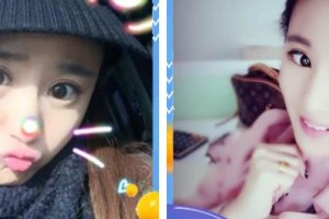 秦皇島巧致美容醫(yī)院胡巧致整形價(jià)格表附切開雙眼皮案例展示