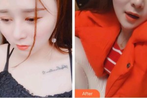 秦皇島口腔醫(yī)院呂楨整形價(jià)格表附超聲波潔牙案例展示