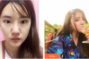 唐山冀東眼科醫(yī)院張云玲整形價格表附眼部綜合案例展示