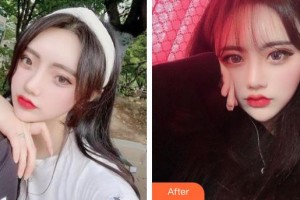 唐山冀東眼科醫(yī)院海整形價格表附開內(nèi)眼角案例展示