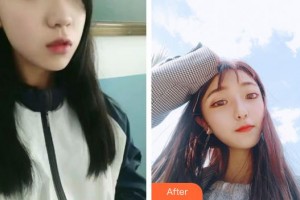 唐山冀東眼科醫(yī)院徐斌整形價格表附切開雙眼皮案例展示