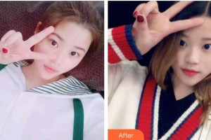 保定牙博士口腔醫(yī)院王鵬整形價(jià)格表附牙貼面案例展示