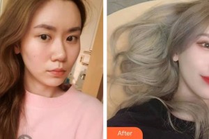 保定新視眼科醫(yī)院劉芳整形價(jià)格表附眼部綜合案例展示