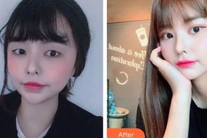 保定新視眼科醫(yī)院武蘊(yùn)琴整形價(jià)格表附眼部綜合案例展示