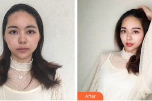 中山小欖人民醫(yī)院整形美容中心李國強(qiáng)整形價(jià)格表附眼部手術(shù)案例展示