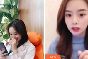 保定東陽口腔醫(yī)院溫興整形價格表附牙貼面案例展示