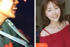 保定東陽口腔醫(yī)院馮春城整形價格表附隱形托槽矯正案例展示