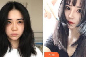 張家口維多利亞醫(yī)療美容醫(yī)院孫凱整形價格表附鼻部綜合案例展示