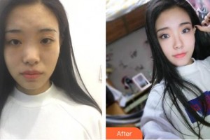 滄州靜港醫(yī)療美容診所季澤東院長整形價(jià)格表附鼻部綜合案例展示