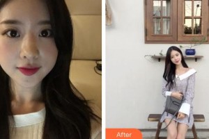 廊坊韓譽國都醫(yī)療美容診所李勇強整形價格表附鼻部綜合案例展示