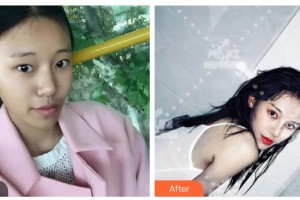 衡水尚美醫(yī)療美容門(mén)診部周林帥整形價(jià)格表附切開(kāi)雙眼皮案例展示