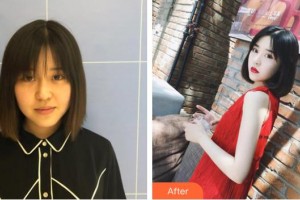 山西省整形外科醫(yī)院高振欣整形價(jià)格表附無針?biāo)獍咐故?>
</a>
<h3 class=