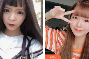 太原晉容整形美容門診部盧永佑整形價格表附硅膠隆鼻案例展示