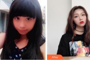 太原塑美美容整形門診部樊捷文整形價(jià)格表附熱瑪吉案例展示