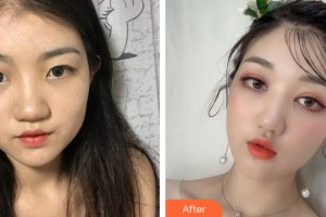 桂林華美醫(yī)療美容門(mén)診部游海鋒整形價(jià)格表附雙眼皮手術(shù)案例展示