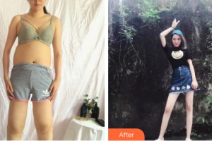 柳州華美整形美容醫(yī)院蘭磊整形價(jià)格表附大腿吸脂案例展示