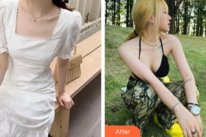 貴陽(yáng)美和諧醫(yī)療美容門診部孫澤芳整形價(jià)格表附隆胸手術(shù)案例展示