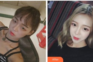 太原愛爾眼科醫(yī)院衛(wèi)留根整形價格表附眼部綜合案例展示