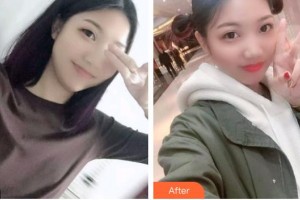 太原恒倫口腔醫(yī)院王屹整形價格表附牙齒陶瓷矯正案例展示