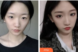 大同清木整形醫(yī)院姜際珠整形價格表附鼻部綜合案例展示