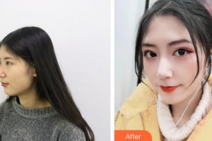 大同魅力舍賓美容診所張斌整形價格表附鼻部綜合案例展示