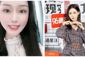 長(zhǎng)治億大口腔醫(yī)院趙喜聰整形價(jià)格表附隱形托槽矯正案例展示