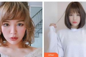 晉城市眼科醫(yī)院趙強(qiáng)整形價(jià)格表附切開雙眼皮案例展示