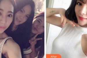 晉中鷹華眼科醫(yī)院張素平整形價(jià)格表附眼部綜合案例展示