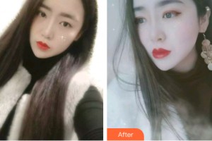 三亞韓氏醫(yī)療美容門診部張慧整形價(jià)格表附牙齒矯正案例展示