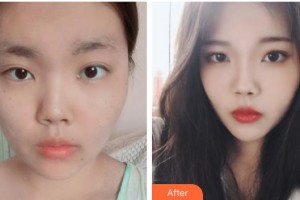 運城麗都整形美容醫(yī)院彭元整形價格表附光子嫩膚案例展示