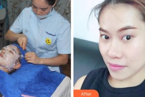 運城海鷗美容外科診所程東海整形價格表附微針?biāo)獍咐故?>
</a>
<h3 class=