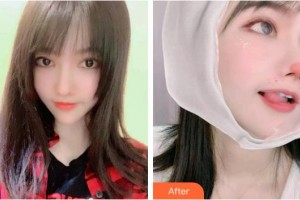 運城市眼科醫(yī)院衛(wèi)晶仙整形價格表附切開雙眼皮案例展示