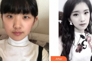 運城市眼科醫(yī)院曲驗兵整形價格表附激光去眼袋案例展示