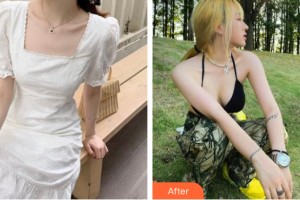 南昌同濟美容醫(yī)院趙雅雄整形價格表附隆胸手術(shù)案例展示